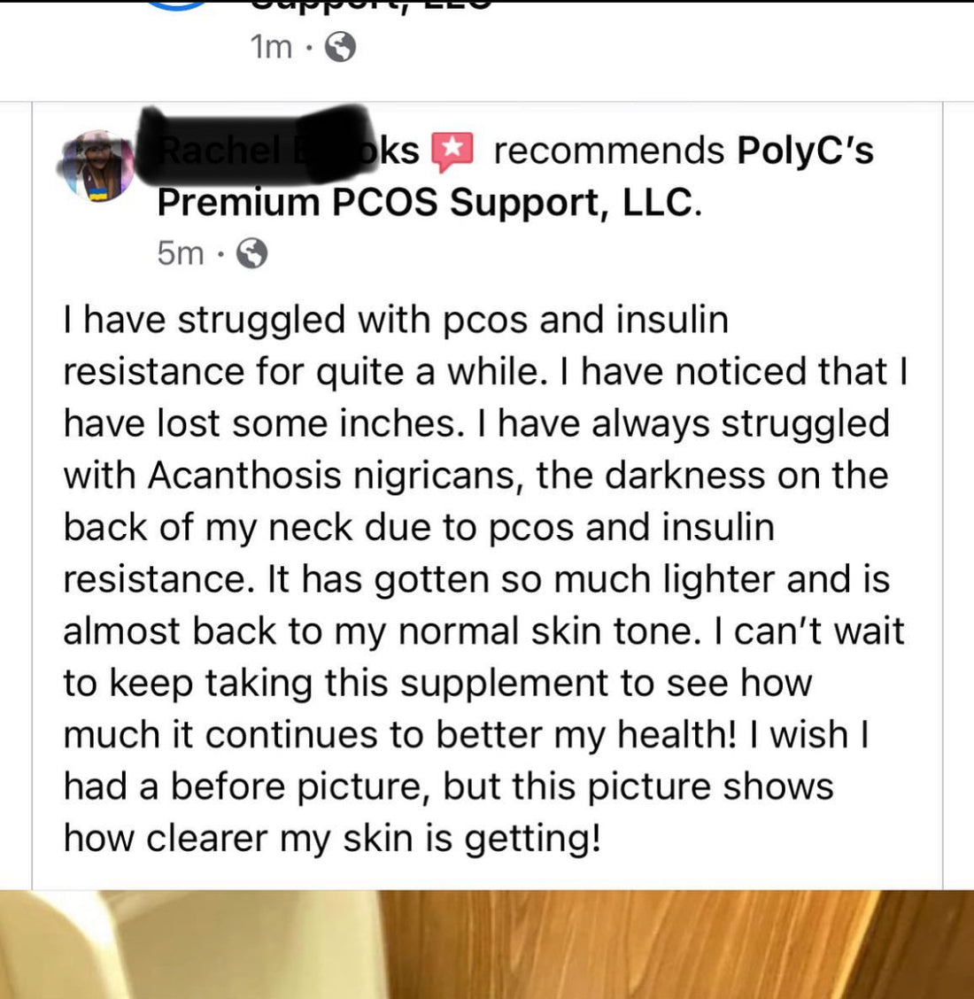 Acanthosis-nigricans PolyC's Premium PCOS